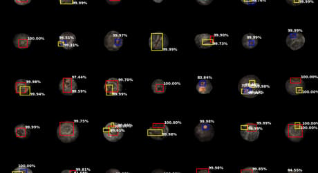 TOMRA artificial intelligence